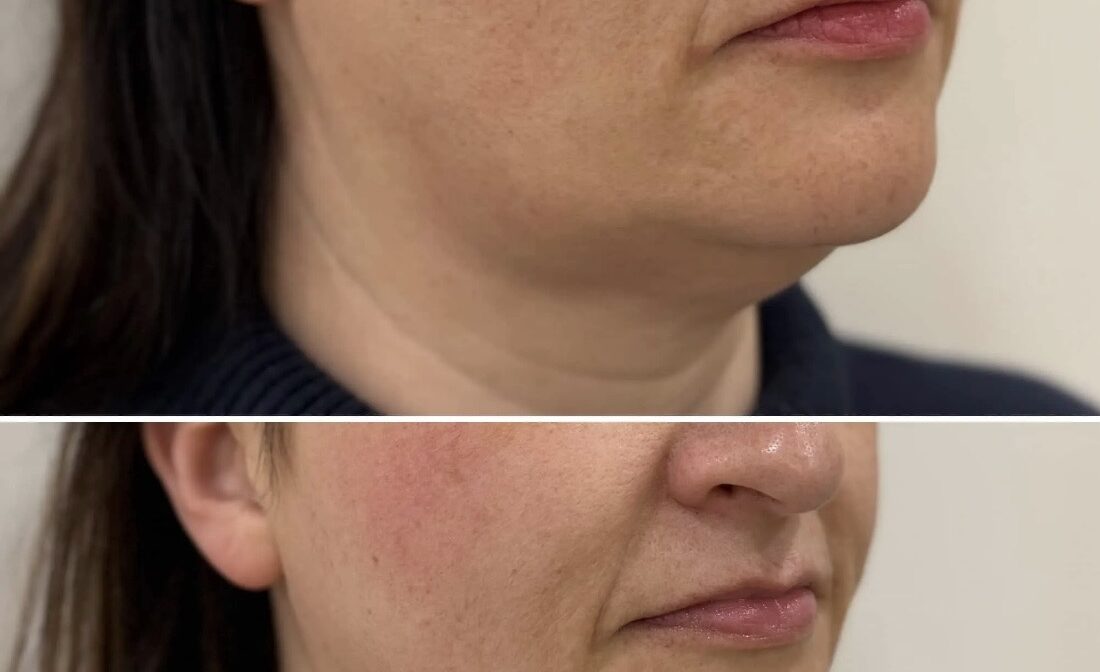 "Nowoczesna medycyna estetyczna 2026 &ndash; co naprawdę działa, a co jest tylko modą?"